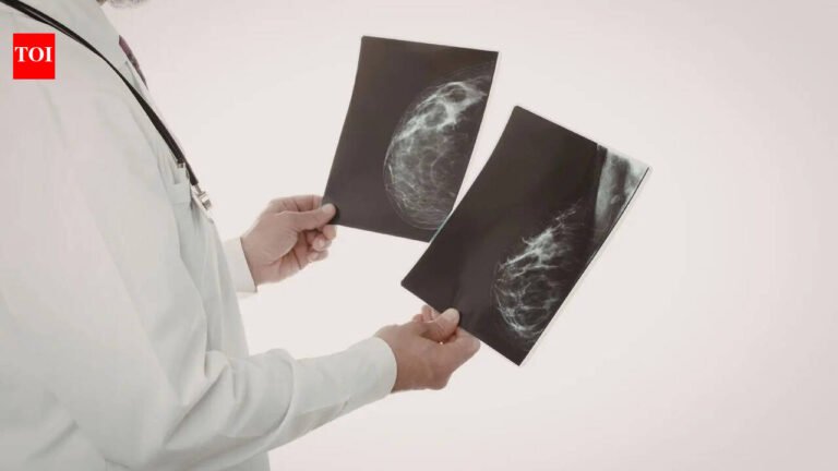 Mammograms are helping docs spot heart disease risk early – The Times of India